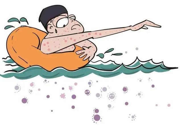 1776307306490465.jpeg 游泳池細菌2.jpeg